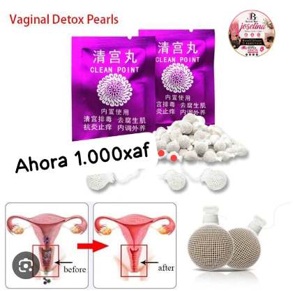Perlas vaginales